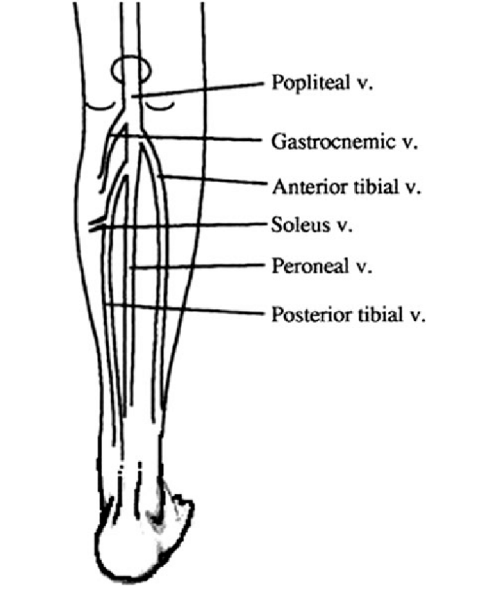 calf-strain-physiopedia