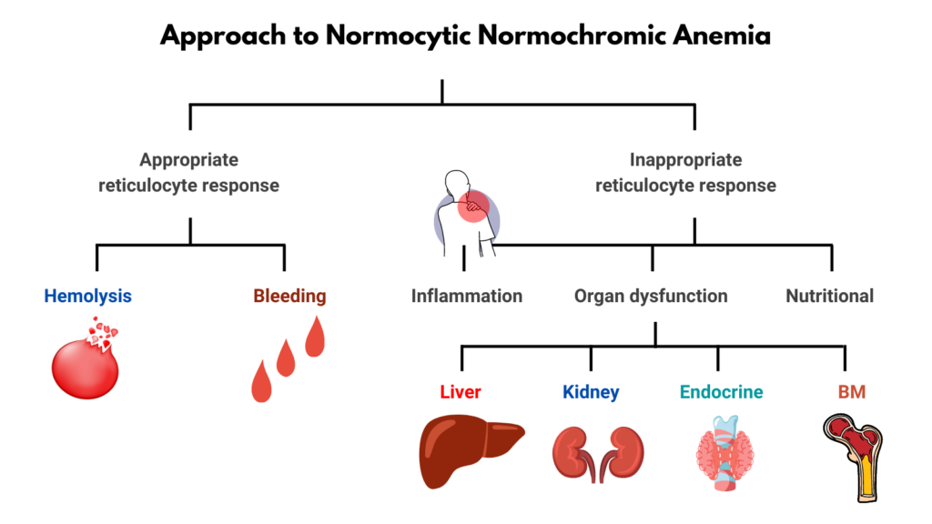 approach-to-normocytic-anemia-the-blood-project