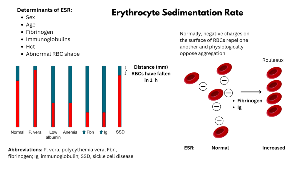 ESR (Erythrocyte Sedimentation Rate) - Focus Dentistry