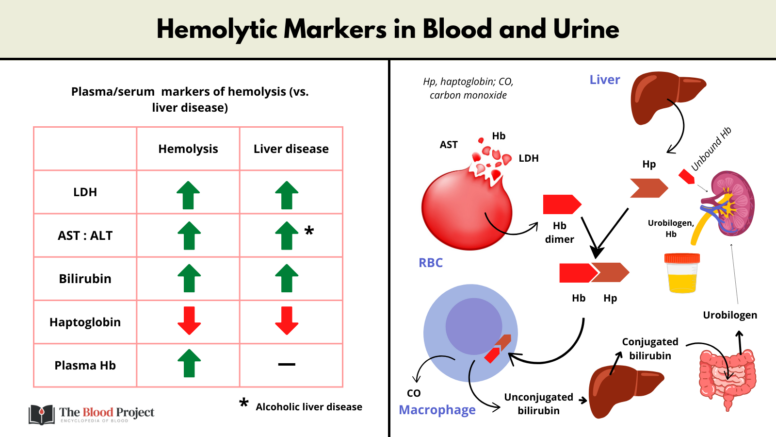 Hemolytic Markers in Blood and Urine • The Blood Project